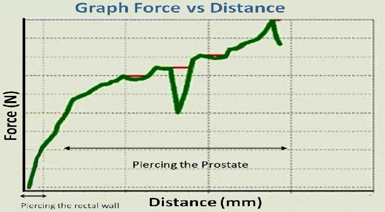 EndFireProstateP_graph.png