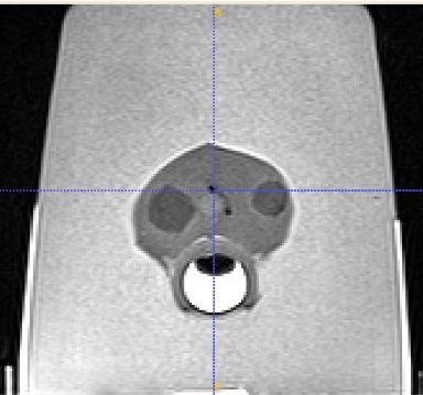 Image of 2 bead markers in MRI modality.